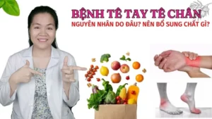 Tê tay chân là thiếu chất gì? Nguyên nhân và cách bổ sung